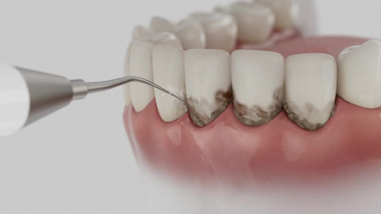 Trusted Teeth Whitening service in Piedmont, OK - Dentist Open Now
